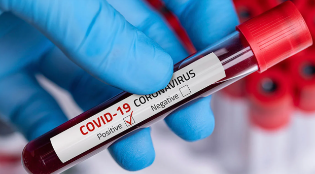 Grupo sanguíneo A es más vulnerable a COVID-19; el O, tiene menor riesgo: estudio